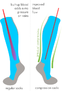 chaussettes de compression graduée